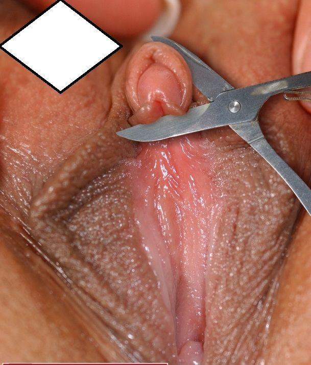 Cutting of clitoris