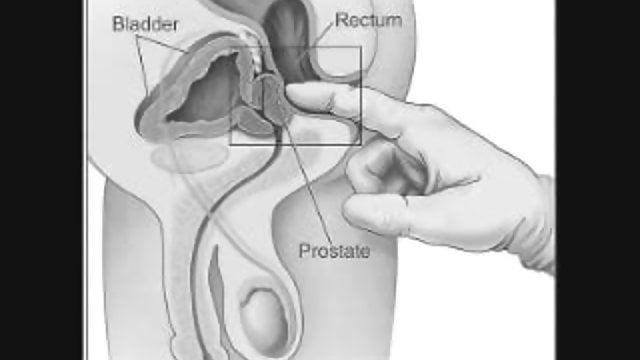 Slobber-knocker reccomend male self prostate