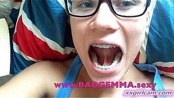 Gemma braces